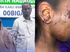 Booliiska gobolka Banaadir oo gacanta kusoo dhigay dad ku eedeysan jirdil iyo dhaawac loo gaystay gabar yar oo 13 jir ah