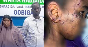 Booliiska gobolka Banaadir oo gacanta kusoo dhigay dad ku eedeysan jirdil iyo dhaawac loo gaystay gabar yar oo 13 jir ah