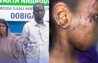 Booliiska gobolka Banaadir oo gacanta kusoo dhigay dad ku eedeysan jirdil iyo dhaawac loo gaystay gabar yar oo 13 jir ah